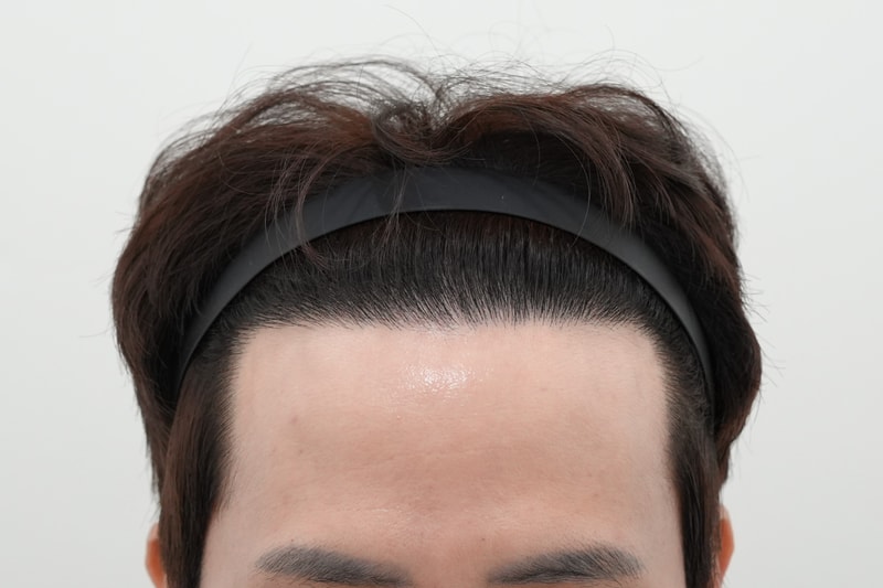 후.jpg