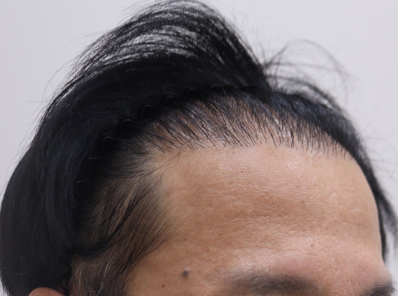 1 수술전_3.JPG