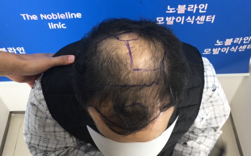 포토후기 이미지