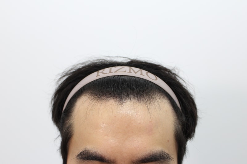 포토후기 이미지