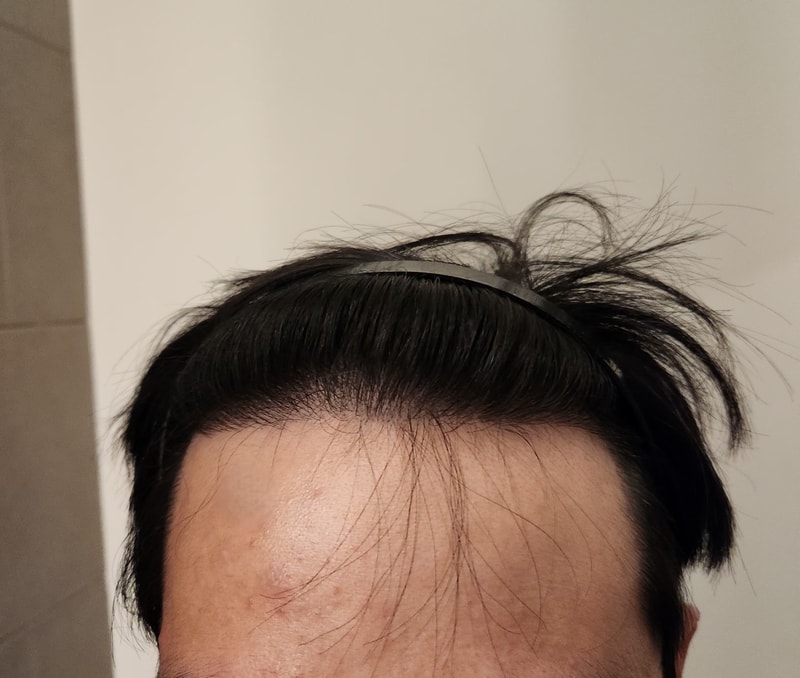 후.jpg