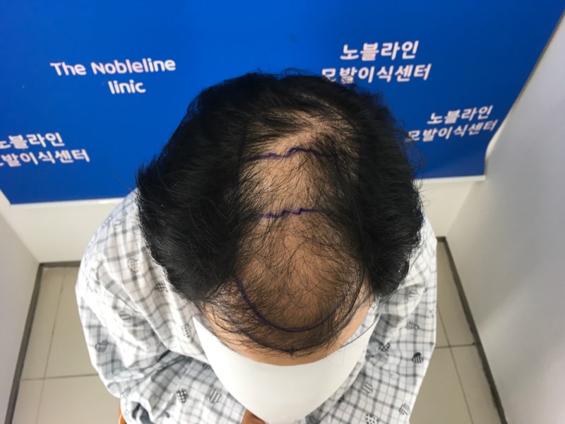 포토후기 이미지