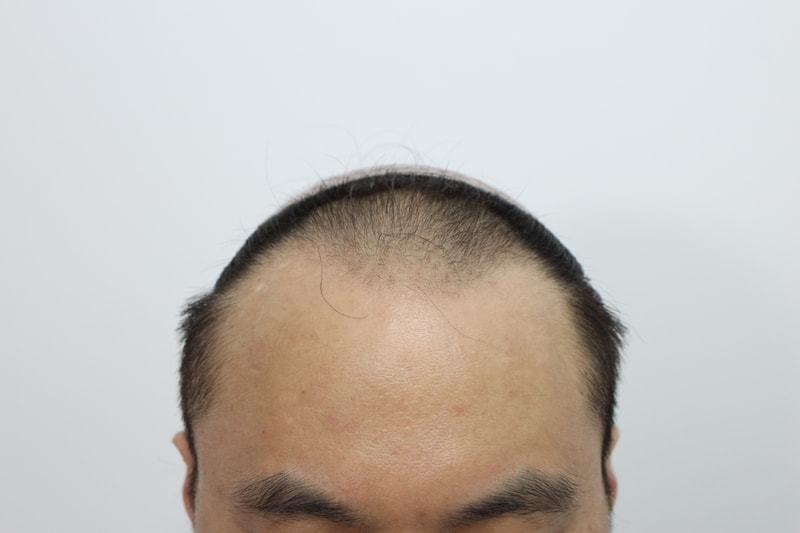 포토후기 이미지