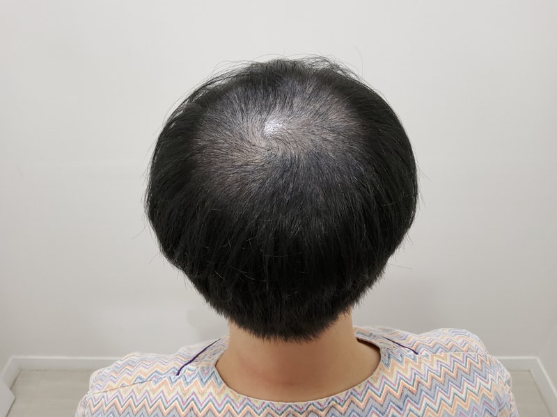 포토후기 이미지