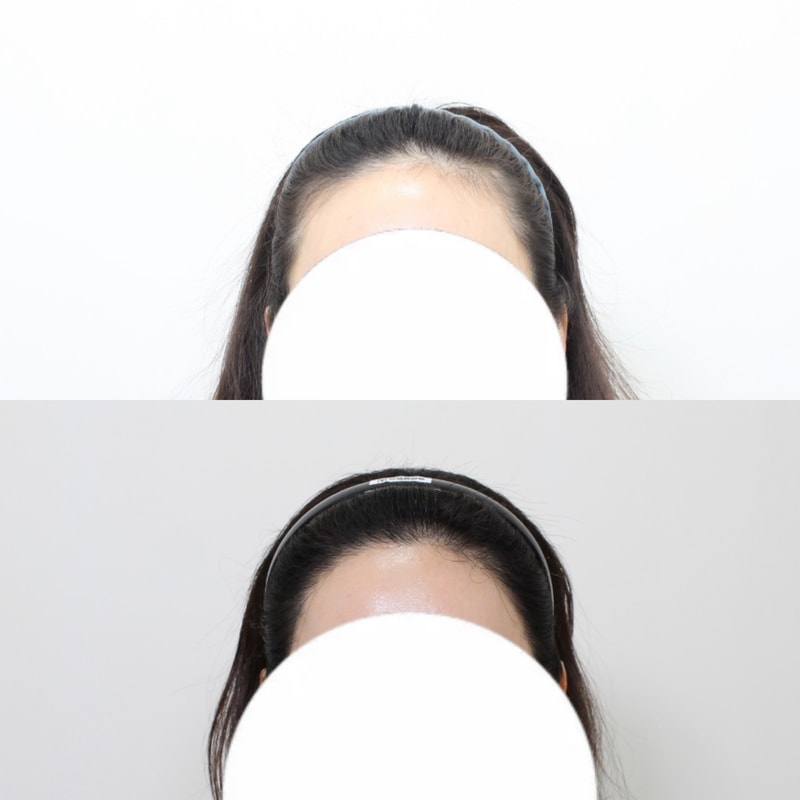 포토후기 이미지