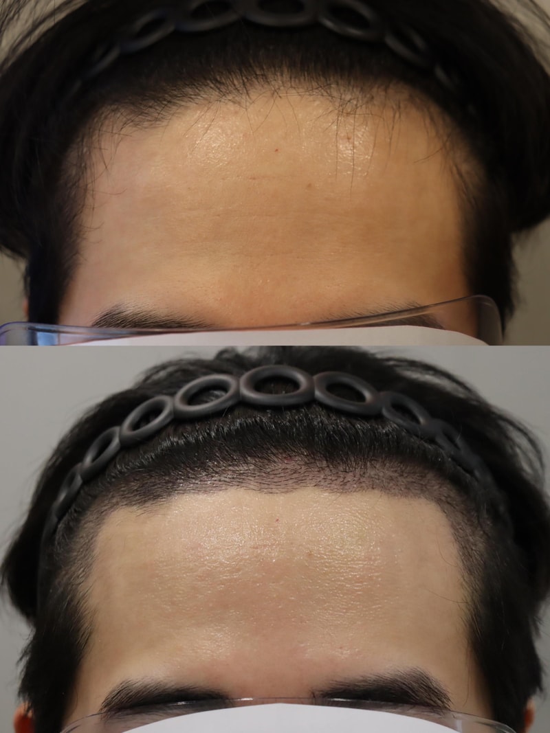 포토후기 이미지