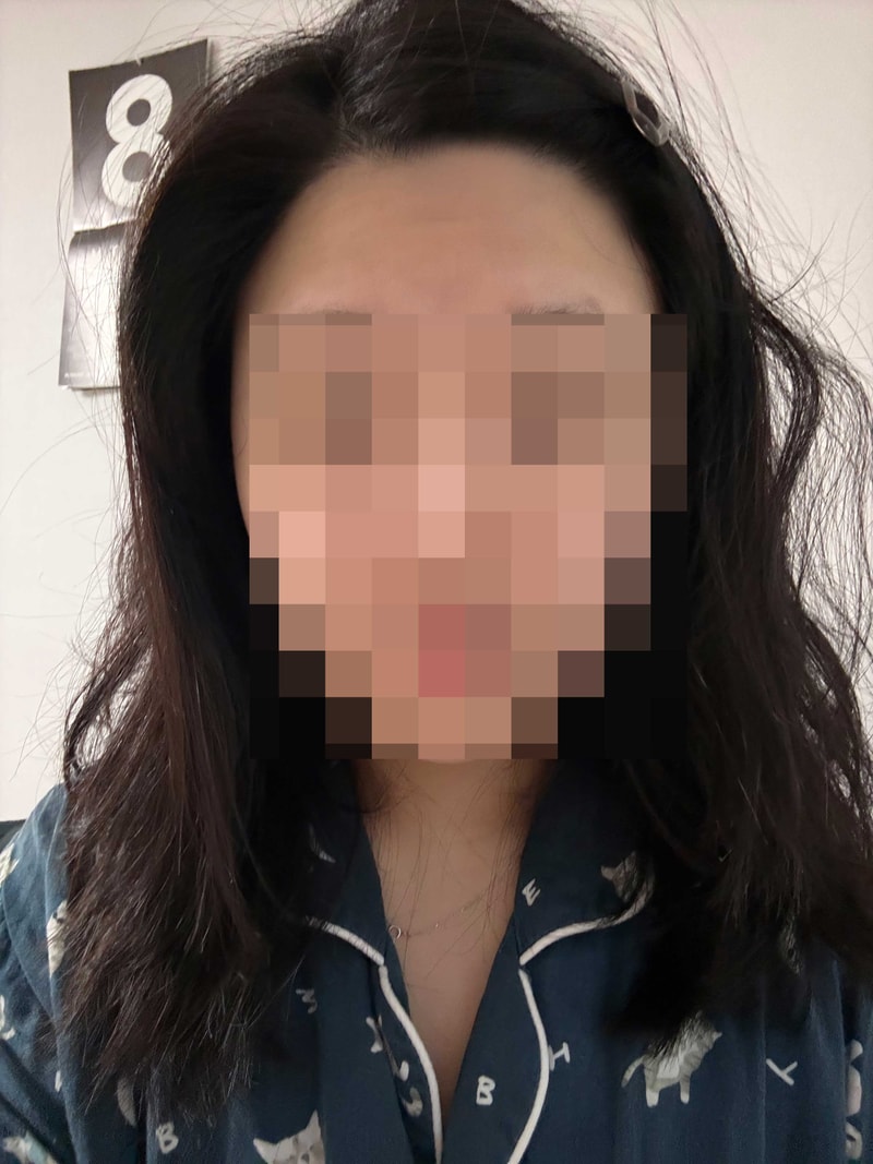 다나성형외과사랑해요.jpg