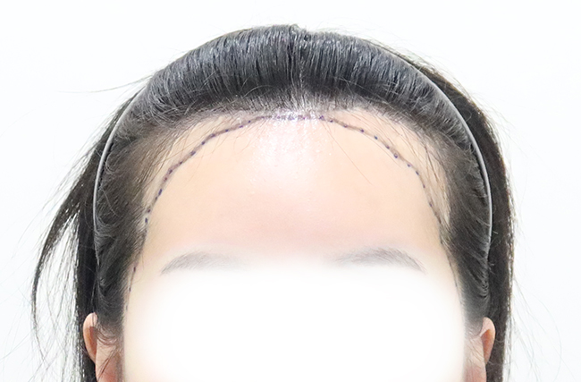 포토후기 이미지