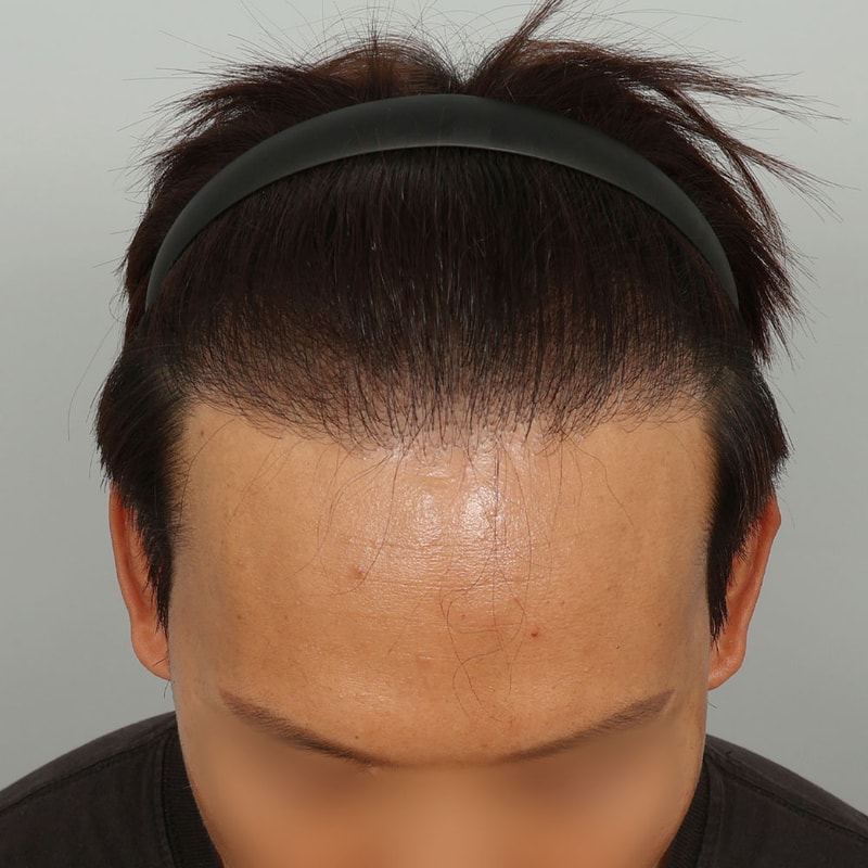 수술 후 282일차 (1).jpg