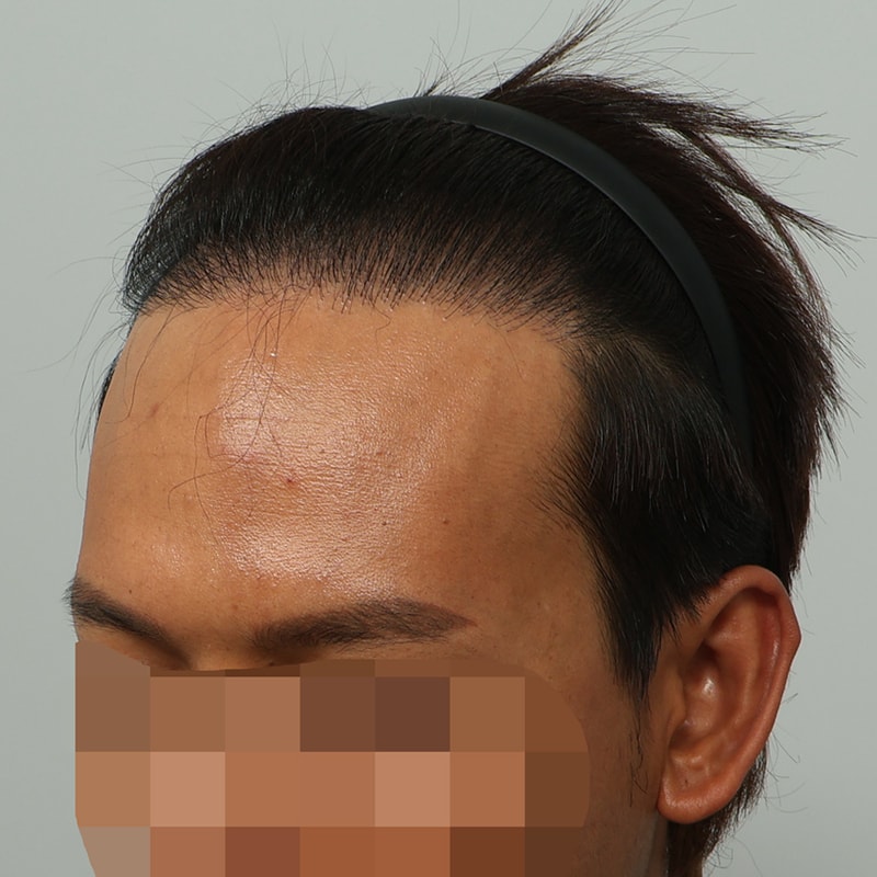 수술 후 282일차 (2).jpg