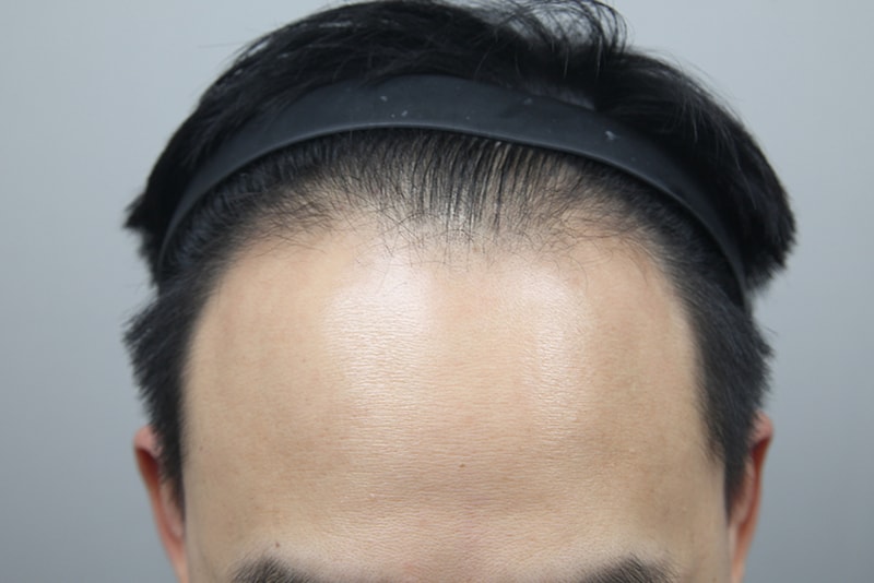 포토후기 이미지