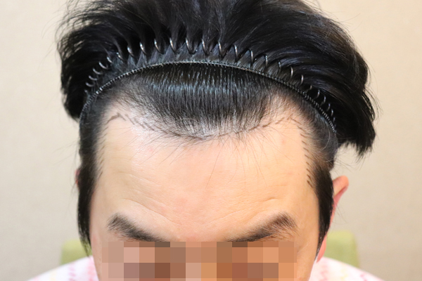 포토후기 이미지