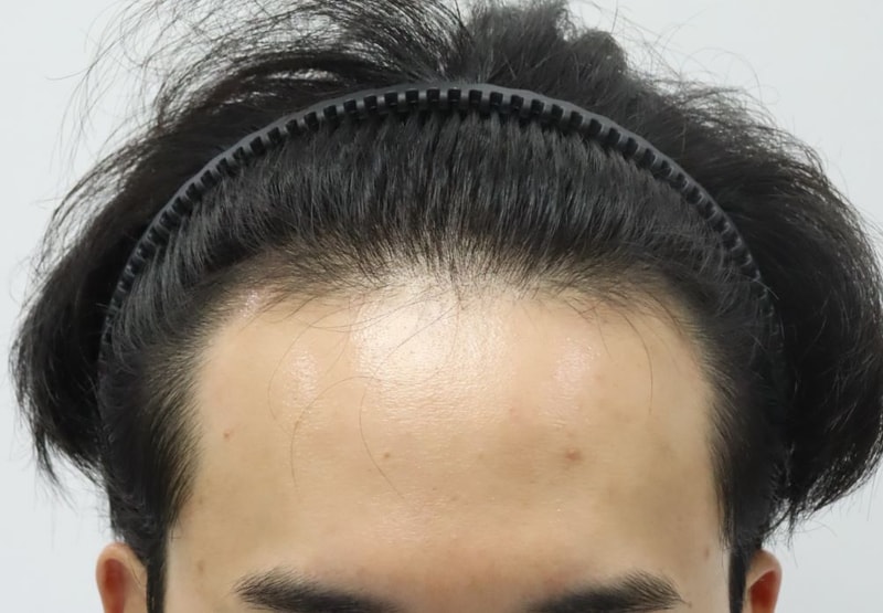 포토후기 이미지
