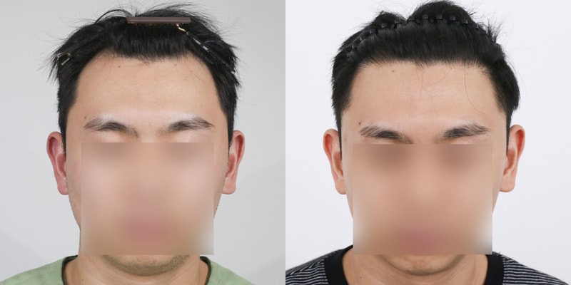 포토후기 이미지