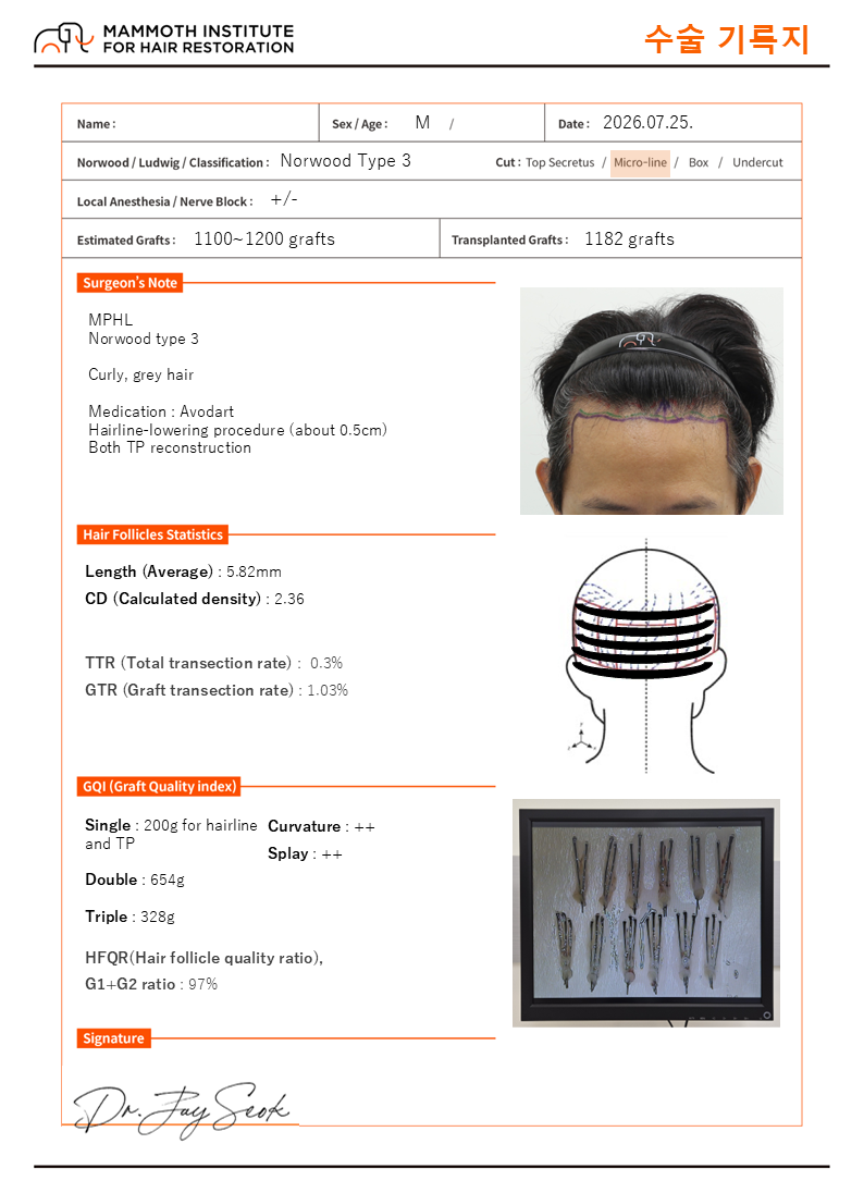 포토후기 이미지