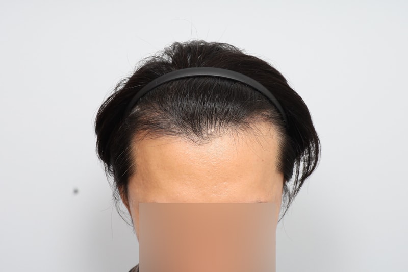 포토후기 이미지