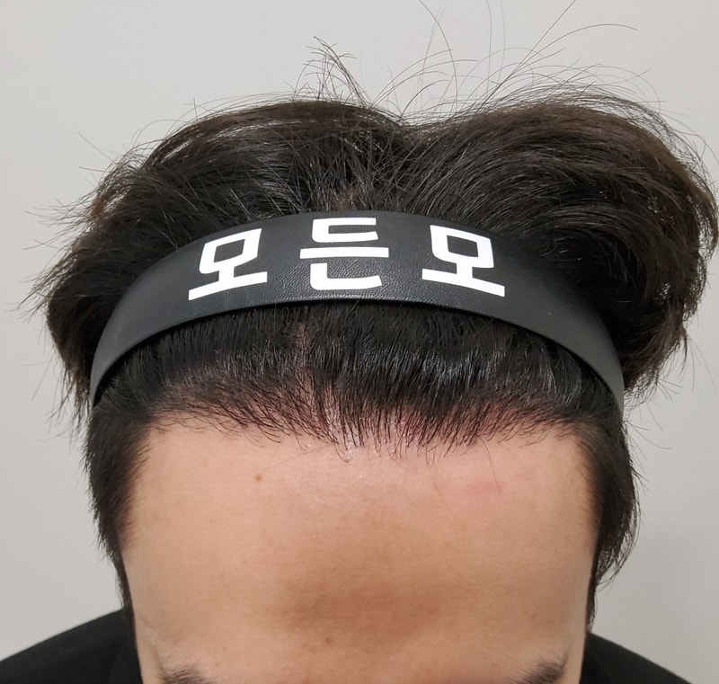 5. 수술후_1년_1.jpg