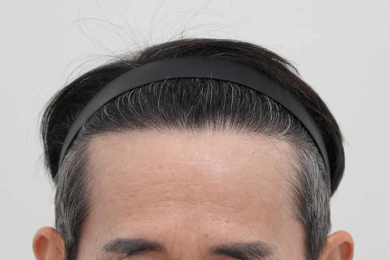 후.jpg