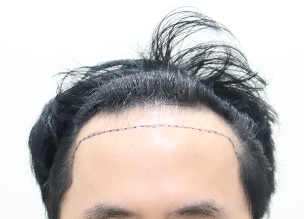 포토후기 이미지