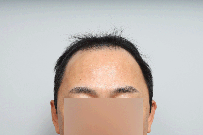 포토후기 이미지
