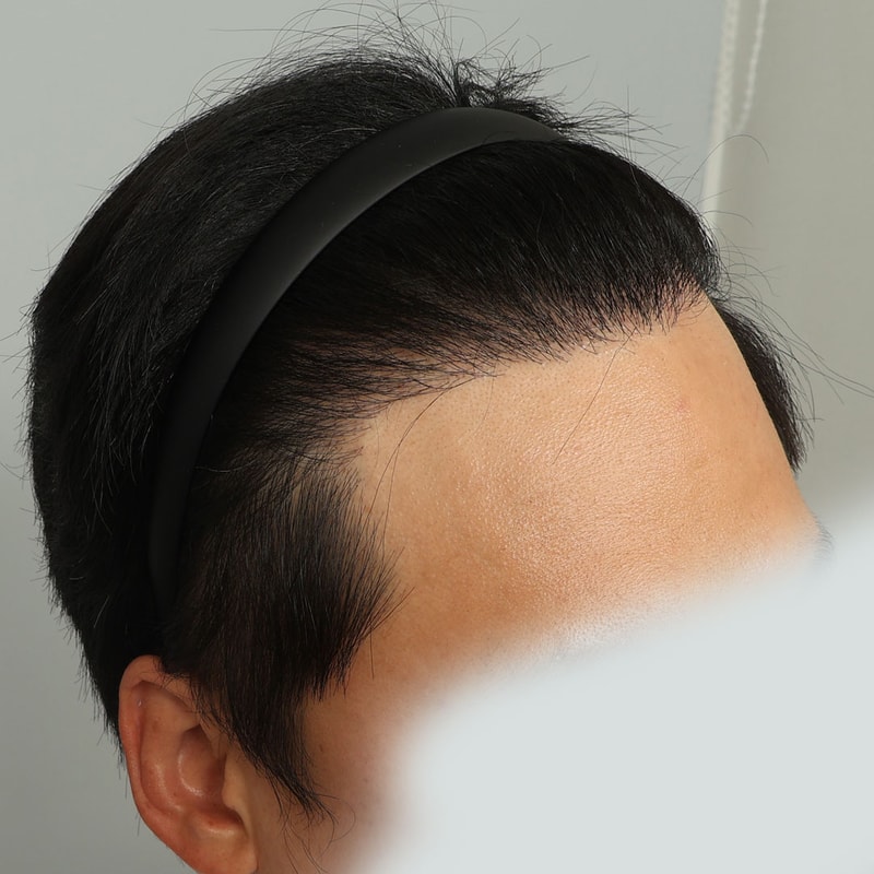 수술 후 358일차 (1).jpg