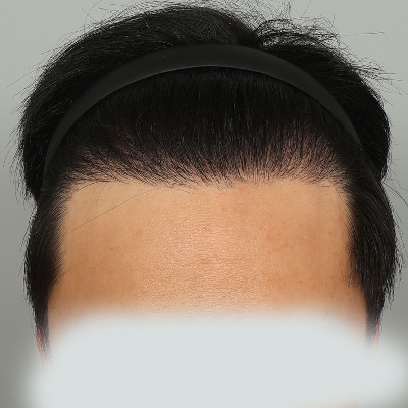 수술 후 358일차 (2).jpg