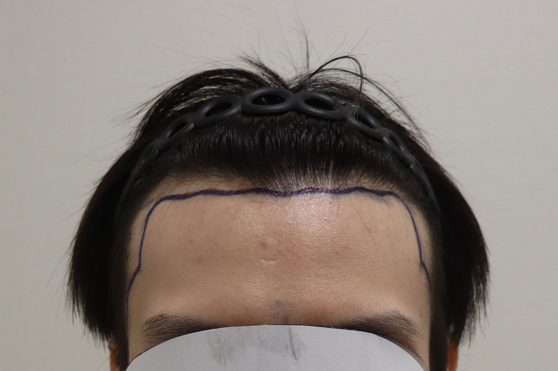 포토후기 이미지