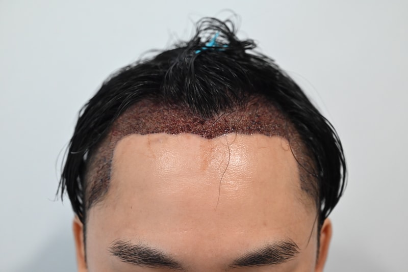 1000010648.jpg