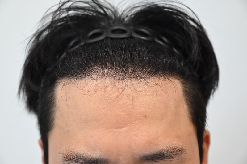 포토후기 이미지