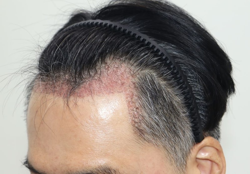 5.1달차.JPG