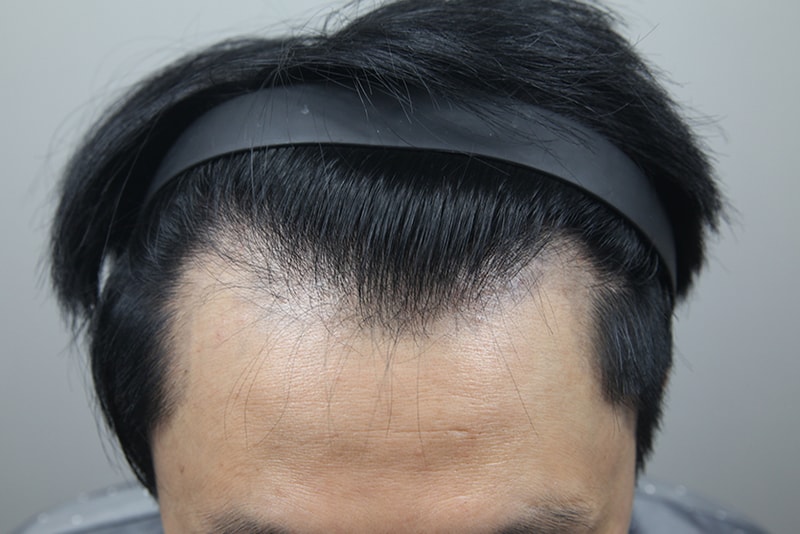 포토후기 이미지