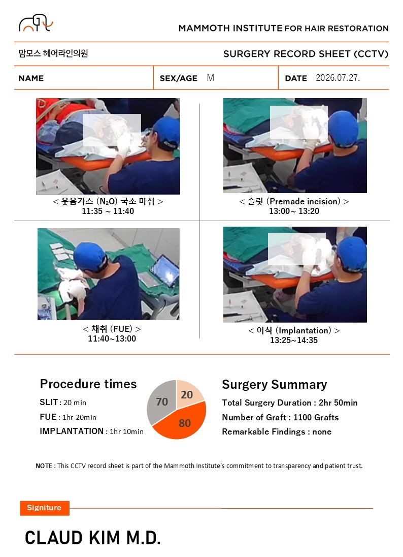 부산 맘모스헤어라인의원 비절개 1100모낭 이식 후기 1일차