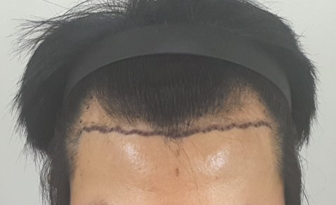 포토후기 이미지