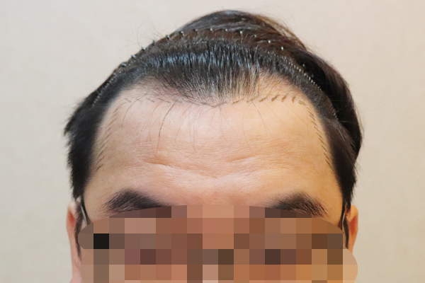 포토후기 이미지