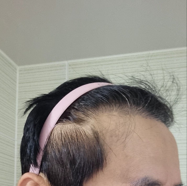 7개월경과.jpg