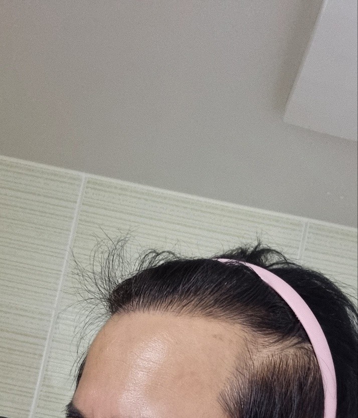 7개월되었습.jpg