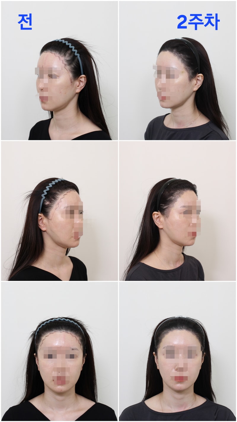 포토후기 이미지