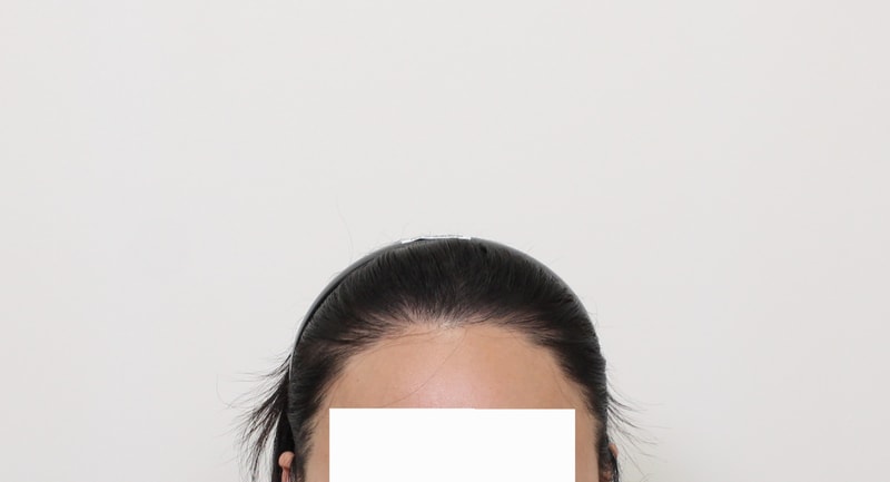 1000027722.jpg