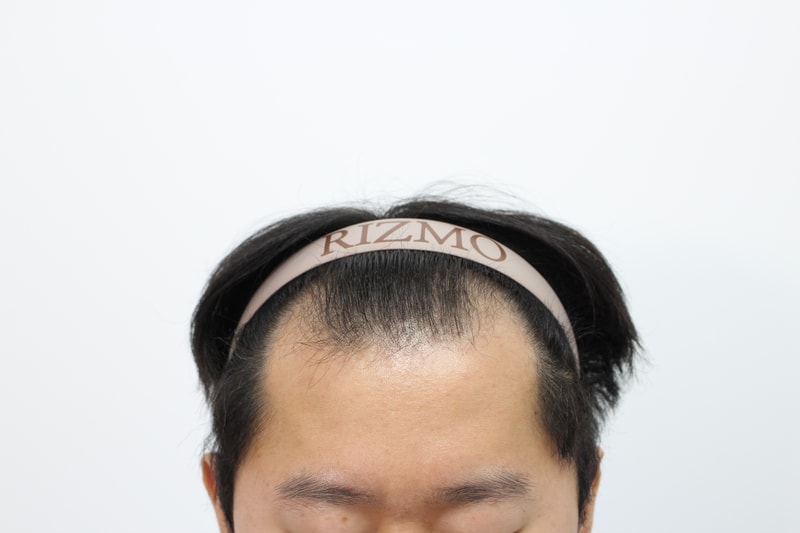 수술전2.JPG