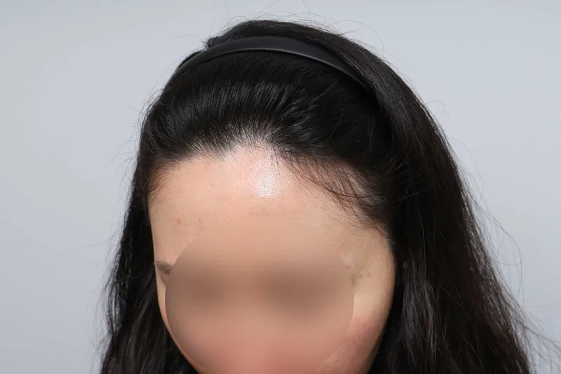 포토후기 이미지