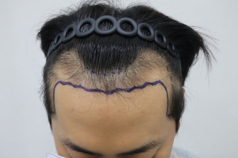 포토후기 이미지