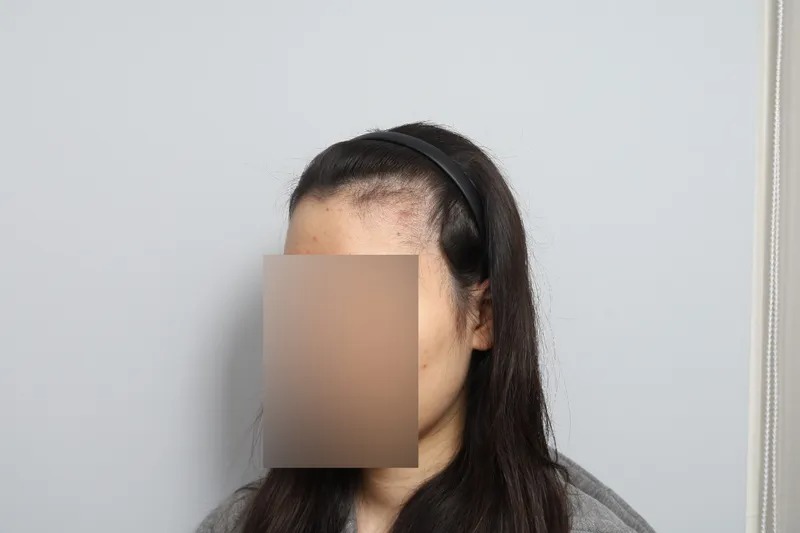 포토후기 이미지
