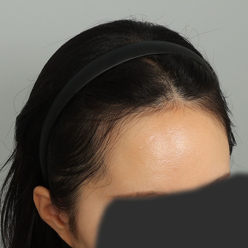 수술 전 (2).jpg