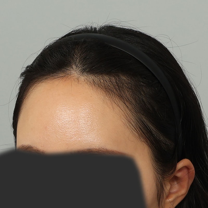 수술 전 (3).jpg