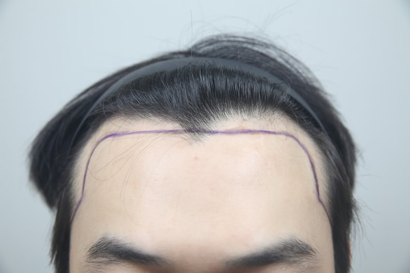포토후기 이미지