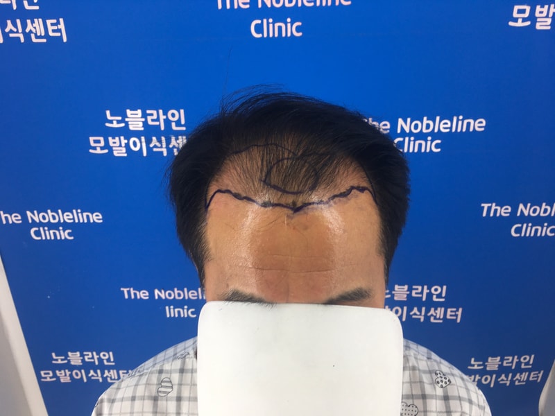 포토후기 이미지