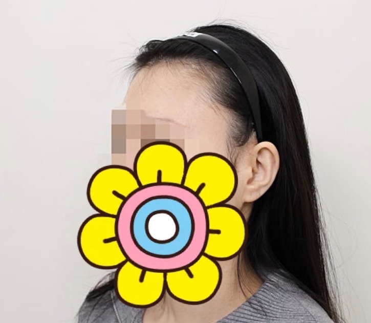 8AFEF048-7D89-4550-B4C7-888DC014DDA1-5115-0000015A9FFA3346.jpeg
