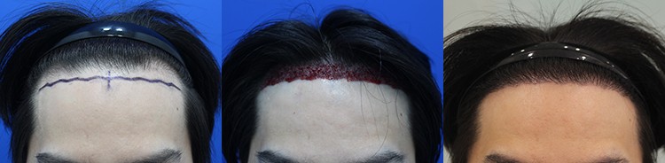 포토후기 이미지