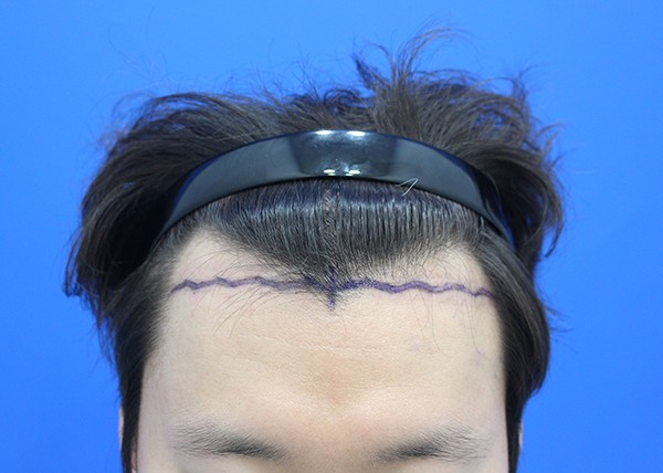 포토후기 이미지