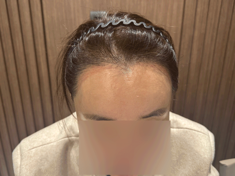 포토후기 이미지